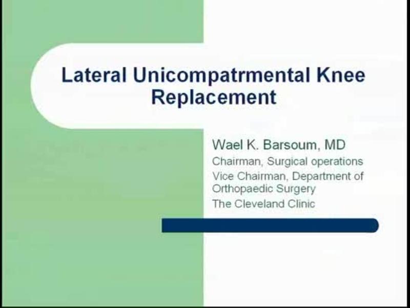 Lateral Unicompatrmental Knee Replacement