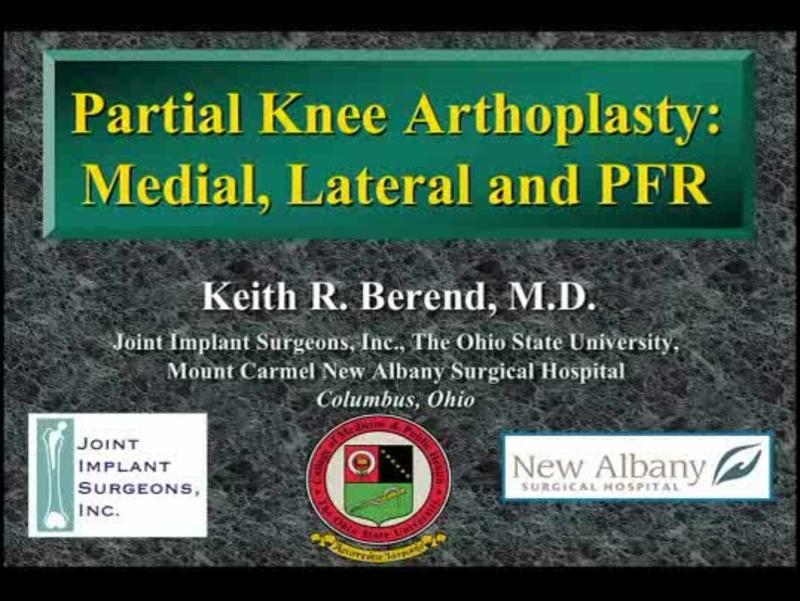 Partial Knee Arthoplasty - Medial, Lateral and PFR