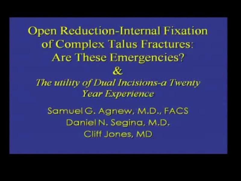 Open Reduction-Internal Fixation of Complex Talus Fractures 