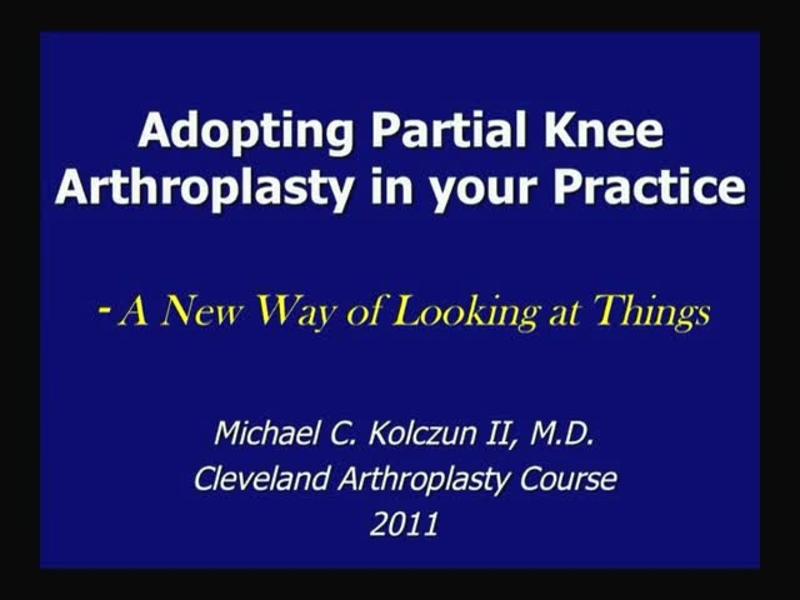 Adopting Partial Knee Arthroplasty in your Practice - A New 