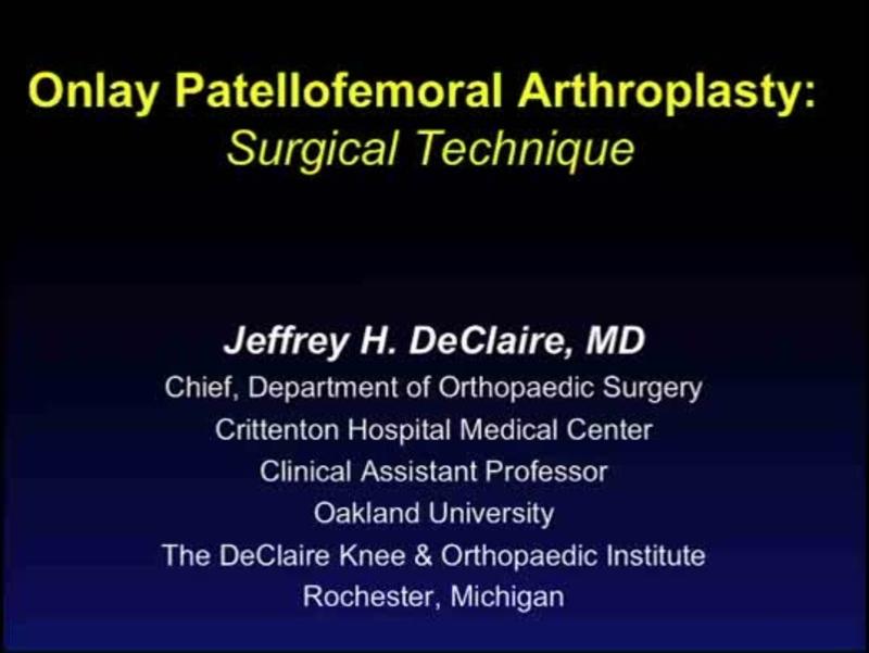 Onlay Patellofemoral Arthroplasty -   Surgical Technique