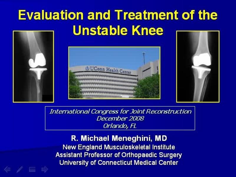 Revision TKA - Evaluation and Treatment of the Unstable Knee