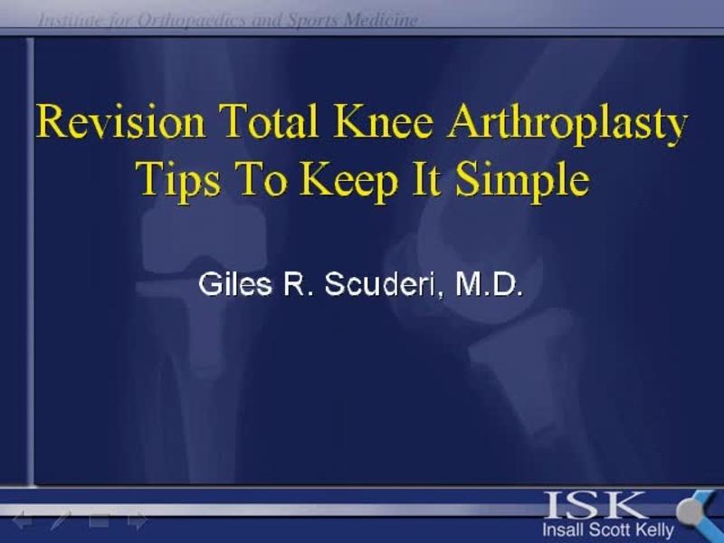Tips to Keep Revision TKA Simple