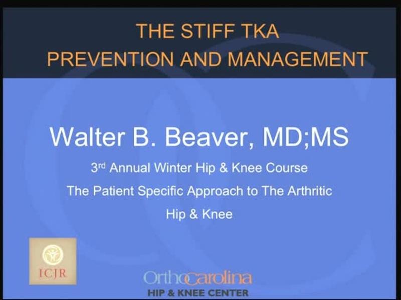 The Stiff TKA - Prevention and Management
