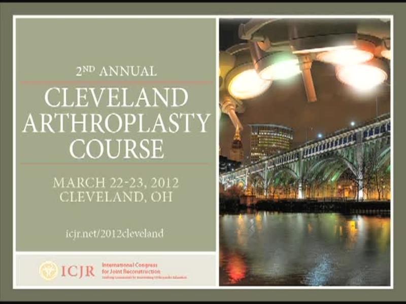 Hip Resurfacing Cleveland Clinic Experience