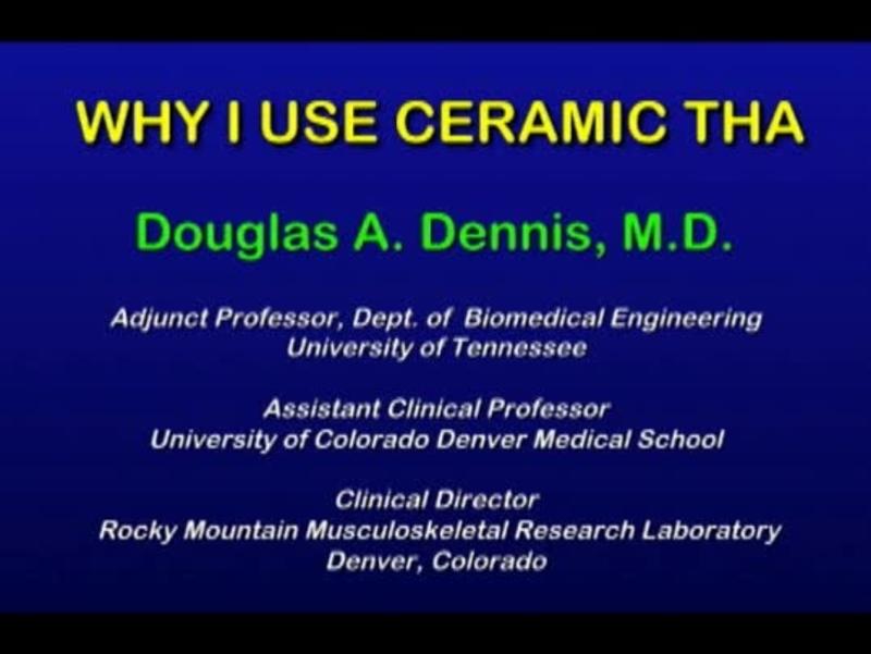 Why I Use Ceramic On Ceramic 