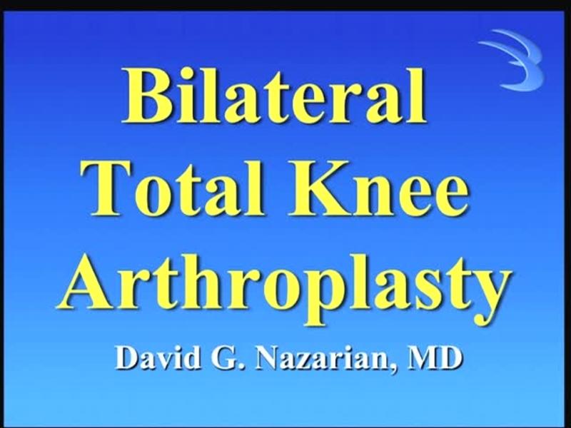 Bilateral Total Knee Arthroplasty