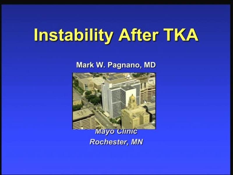 Instability After TKA