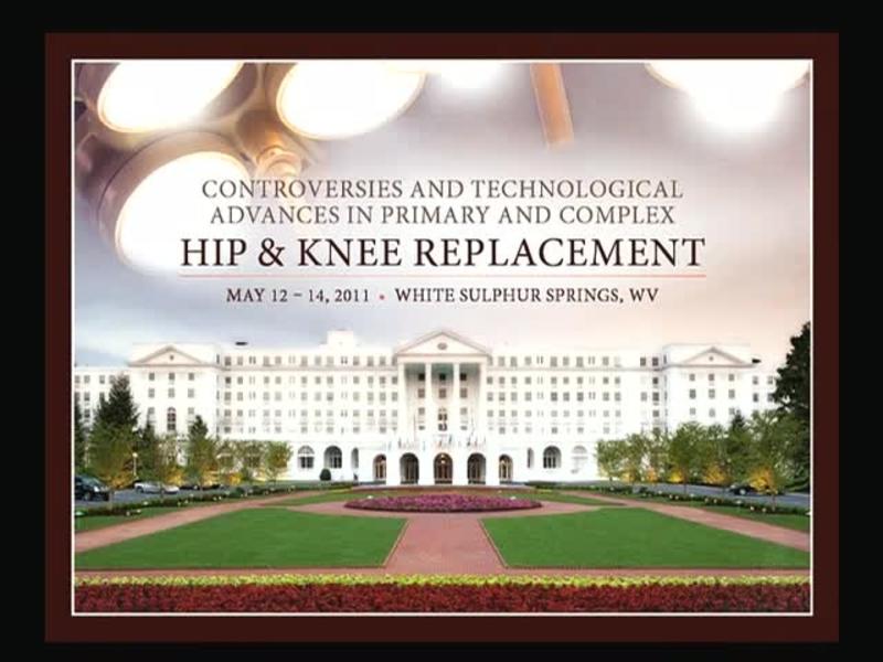Lateral Unicompartmental Knee Arthroplasty via a Lateral Par