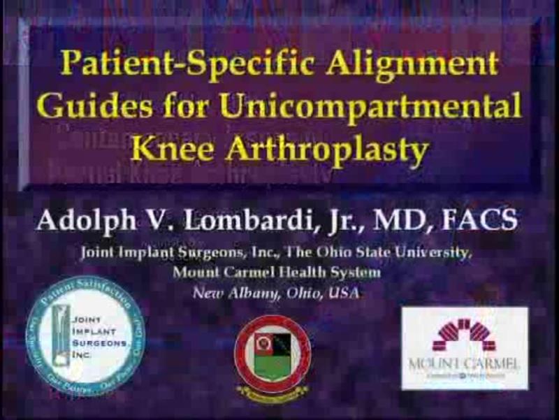Patient-Specific Alignment Guides for Unicompartmental Knee 