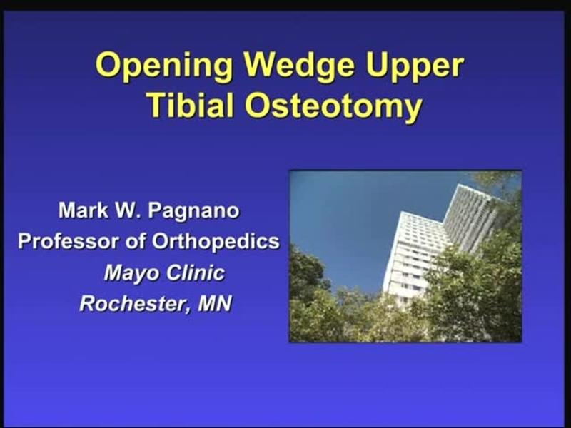 Opening Wedge Upper Tibial Osteotomy