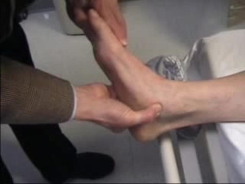 Adult flatfoot reconstruction