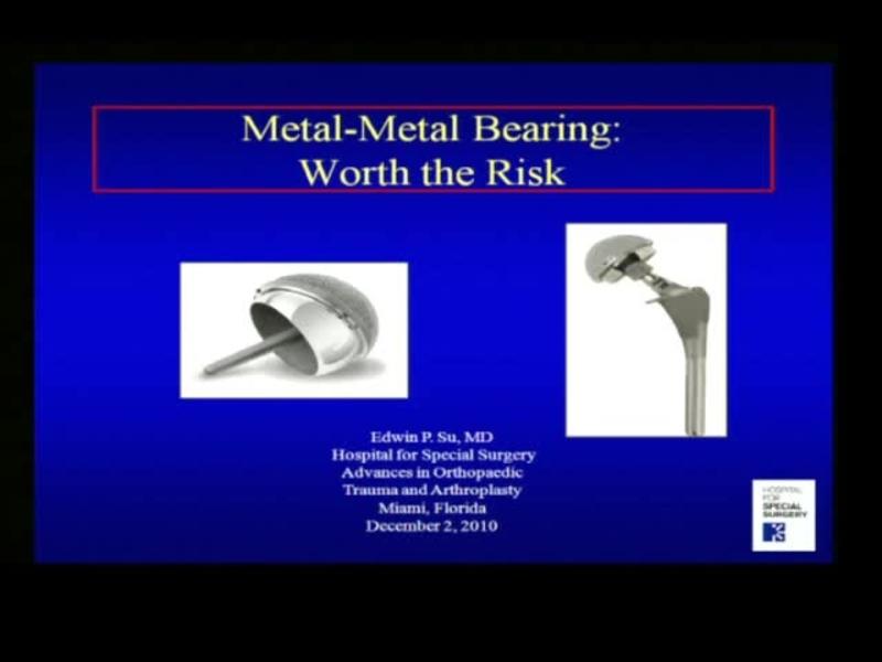 Metal-Metal Bearing - Worth the Risk