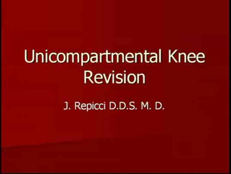 Unicompartmental Knee Revision