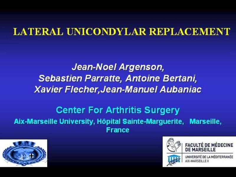 Lateral Unicondylar Knee Replacement