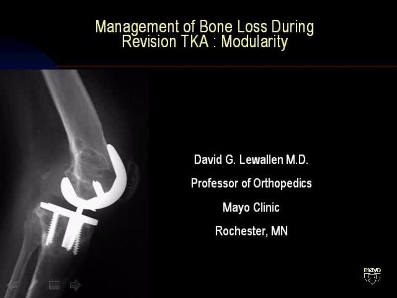 Management of Bone Defects in TKA