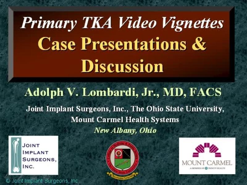 Primary TKA - Discussion