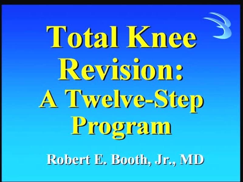 Total Knee Revision - A Twelve-Step Program