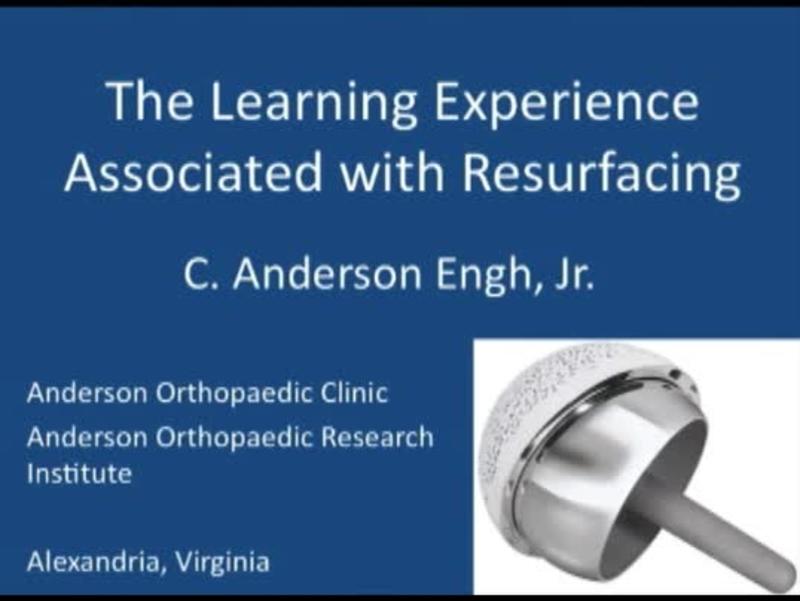 The Learning Experience Associated With Resurfacing 