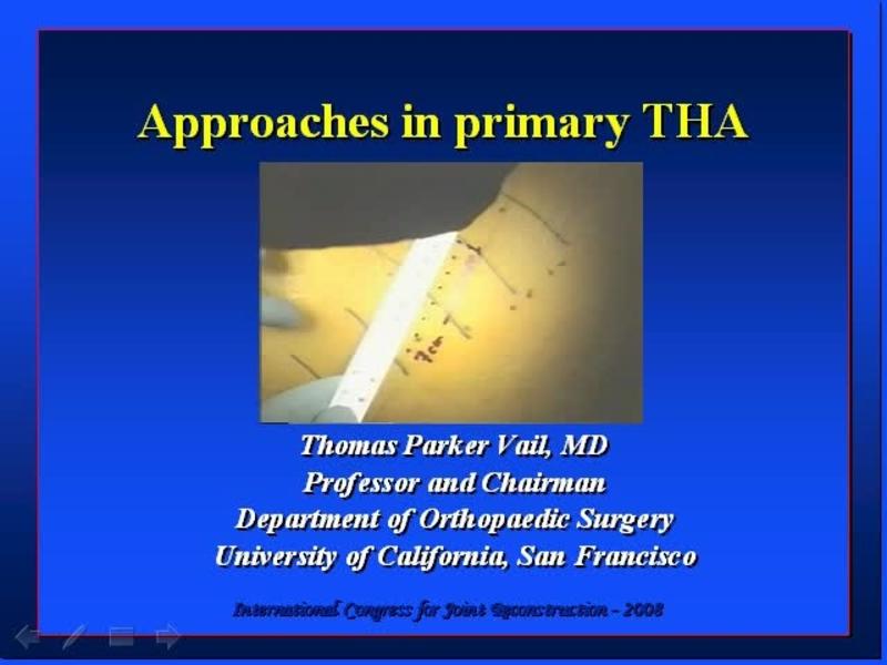 Approaches in Primary THA - Discussion