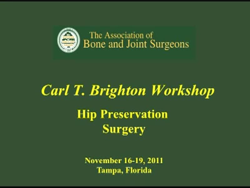 Pincer FAI - Does Coverage Matter