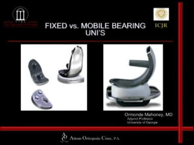Fixed vs Mobile UNI's 