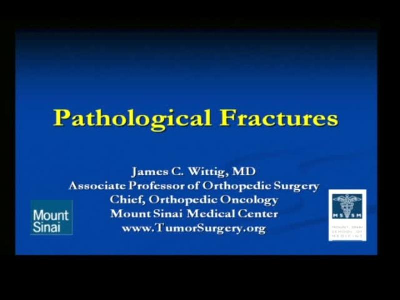 Pathological Fractures