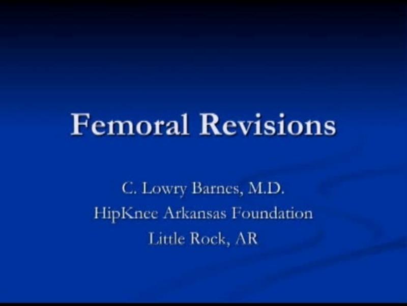 Femoral Deficiency 