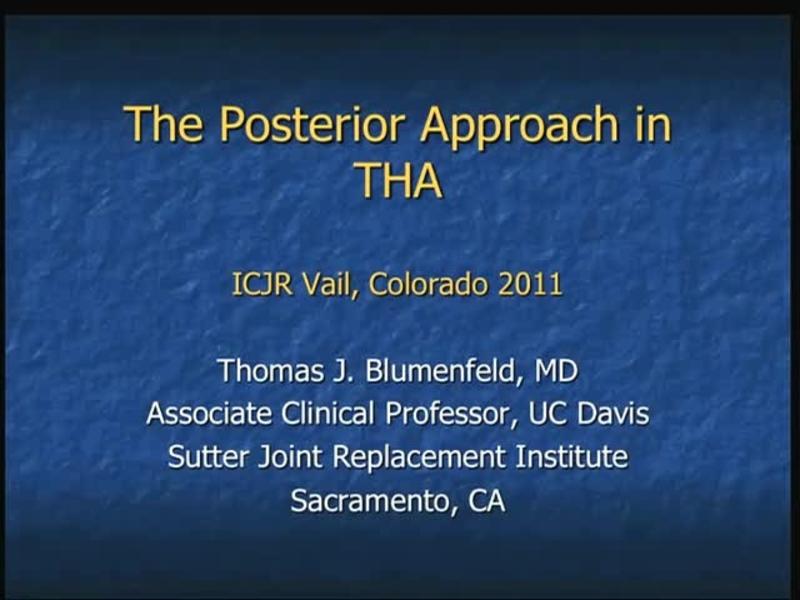 The Posterior Approach in THA