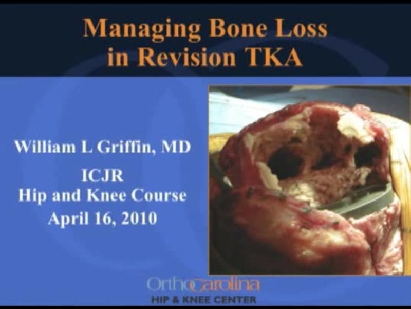 Management Of Bone Defects