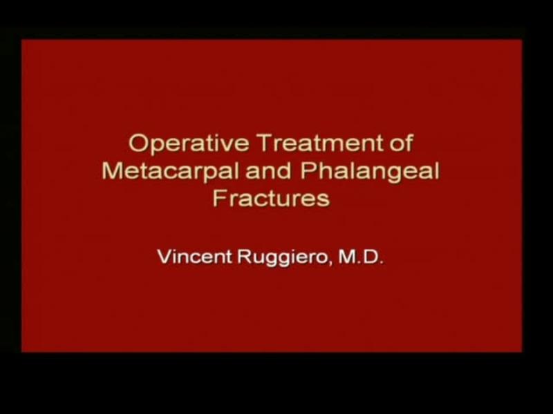 Operative Treatment of Metacarpal and Phalangeal Fractures