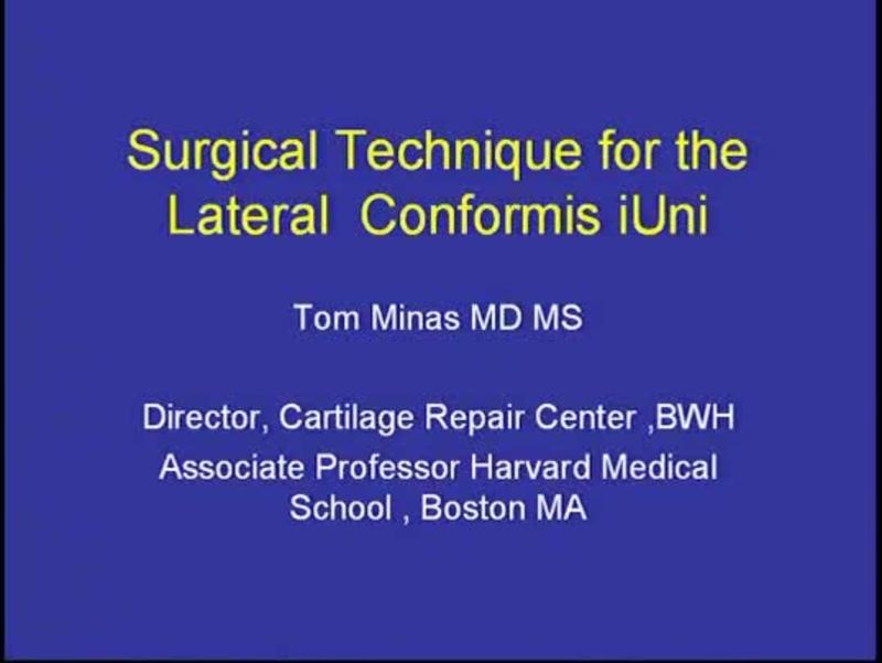 Surgical Technique for the Lateral  Conformis iUni