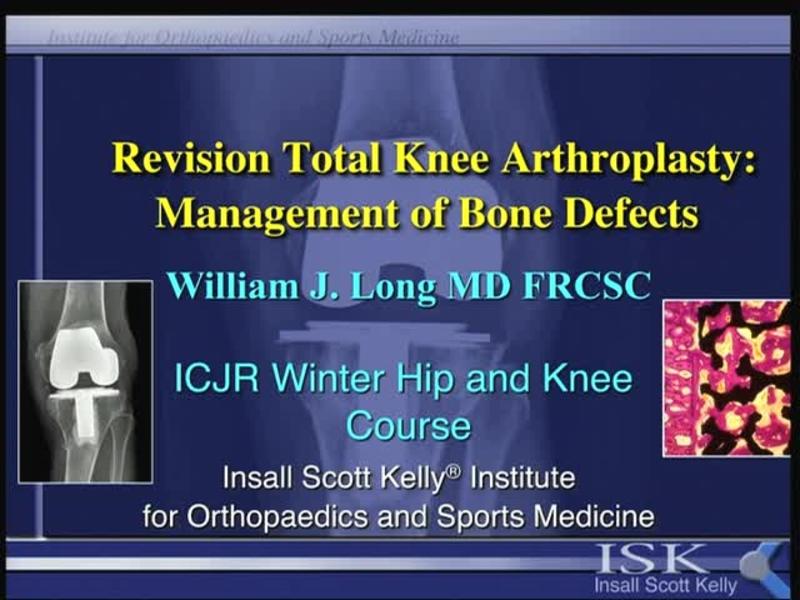 Revision Total Knee Arthroplasty - Management of Bone Defect