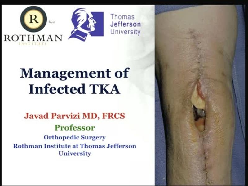 Management of Infected TKA