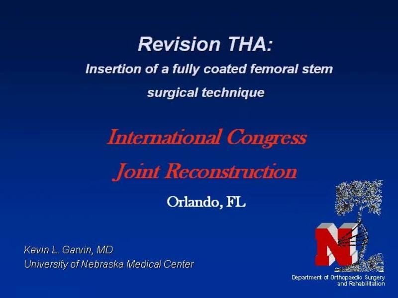 Insertion of a Fully Coated Femoral Stem