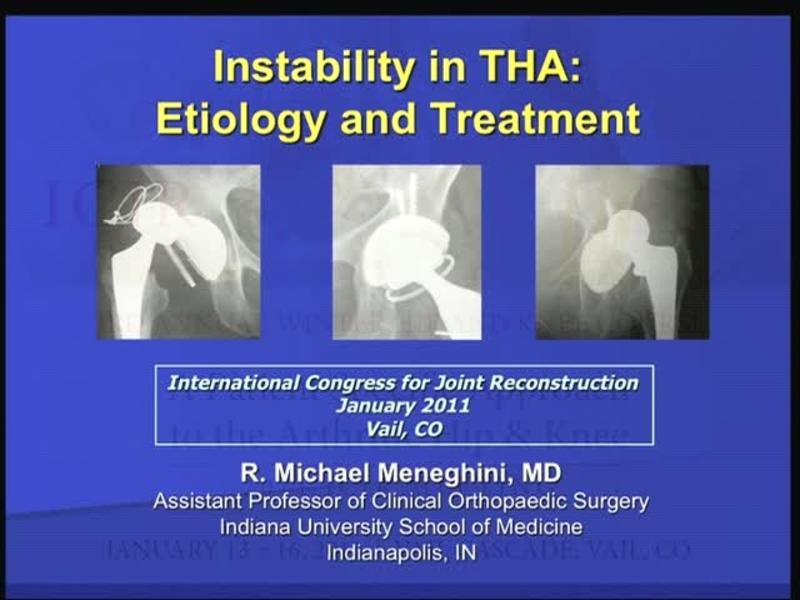 Instability in THA - Etiology and Treatment