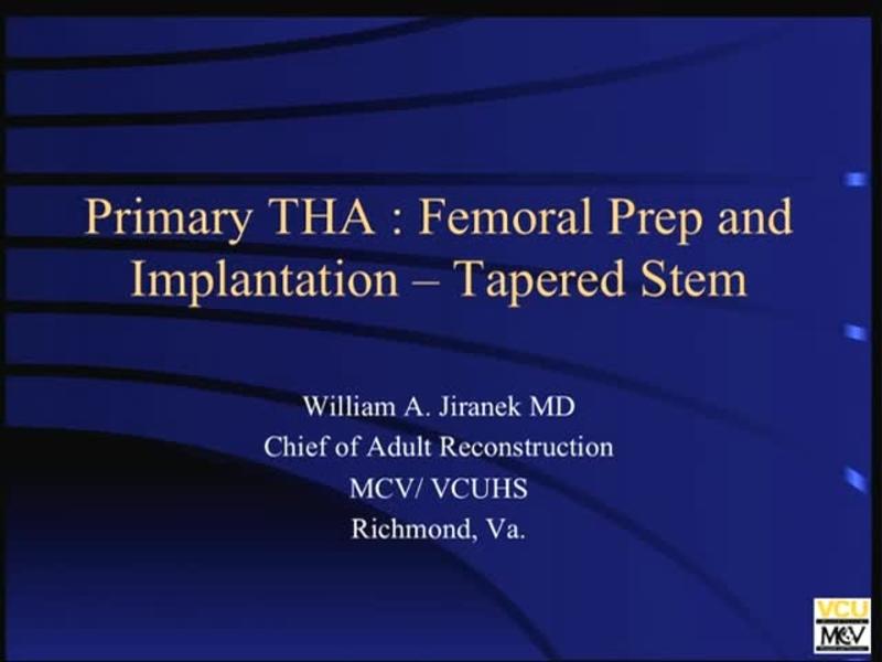 Primary THA  - Femoral Prep and Implantation   Tapered Stem