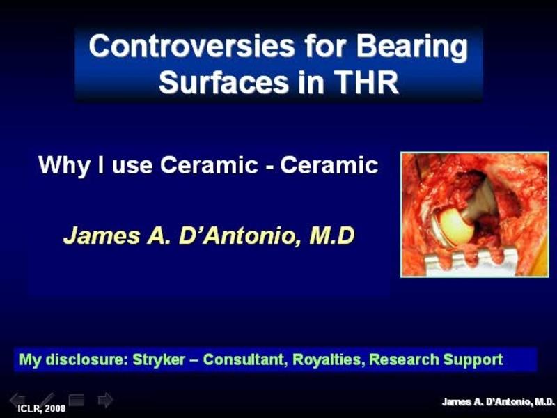 Why I Use Ceramic-Ceramic