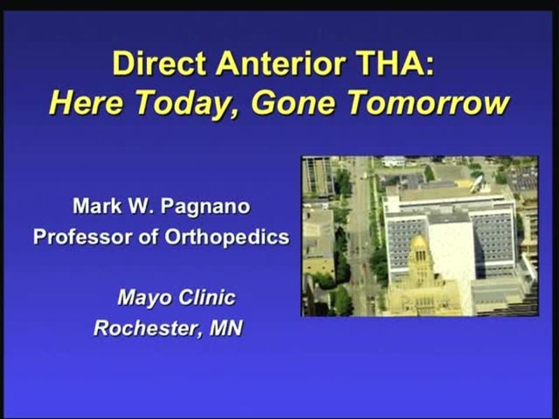 Direct Anterior THA - Here Today, Gone Tomorrow