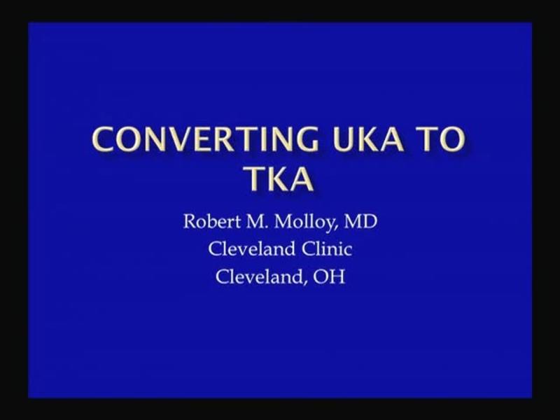 Converting UKA to TKA