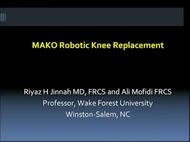 MAKO Robotic Knee Replacement 