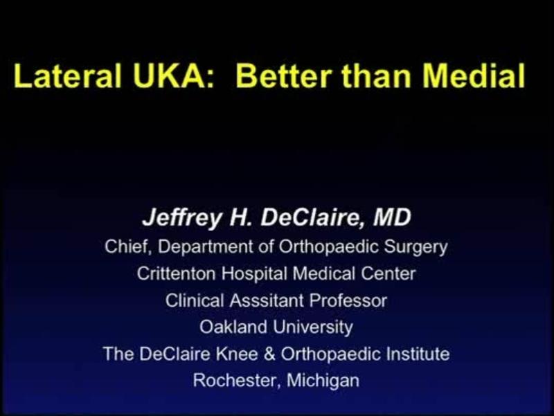 Lateral UKA -  Better than Medial