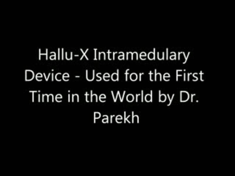 1st MTP Fusion with Intramedullary Device
