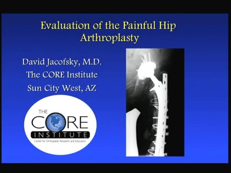Evaluation of the Painful Hip Arthroplasty