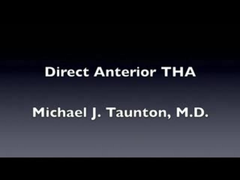 Direct Anterior Total Hip Arthroplasty