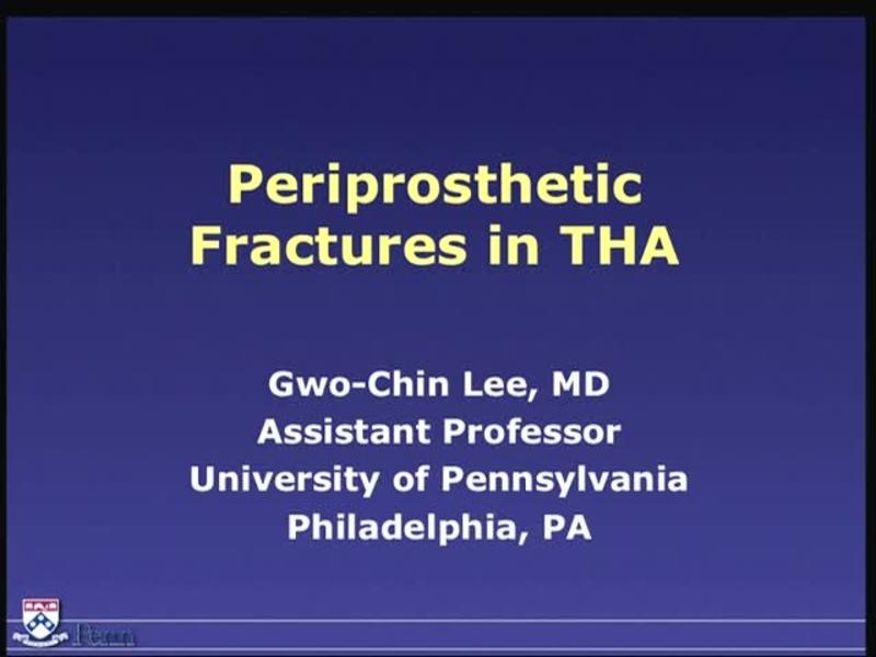 Periprosthetic Fractures in THA