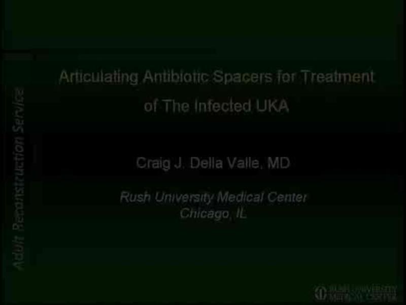 Articulating Antibiotic Spacers for Treatment of The Infecte
