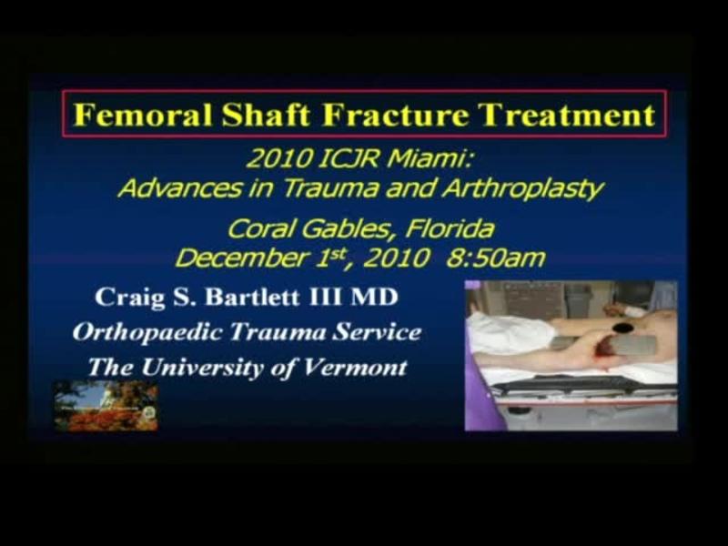 Femoral Shaft Fracture Treatment