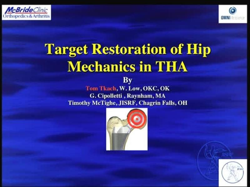 Target Restoration of Hip Mechanics in THA
