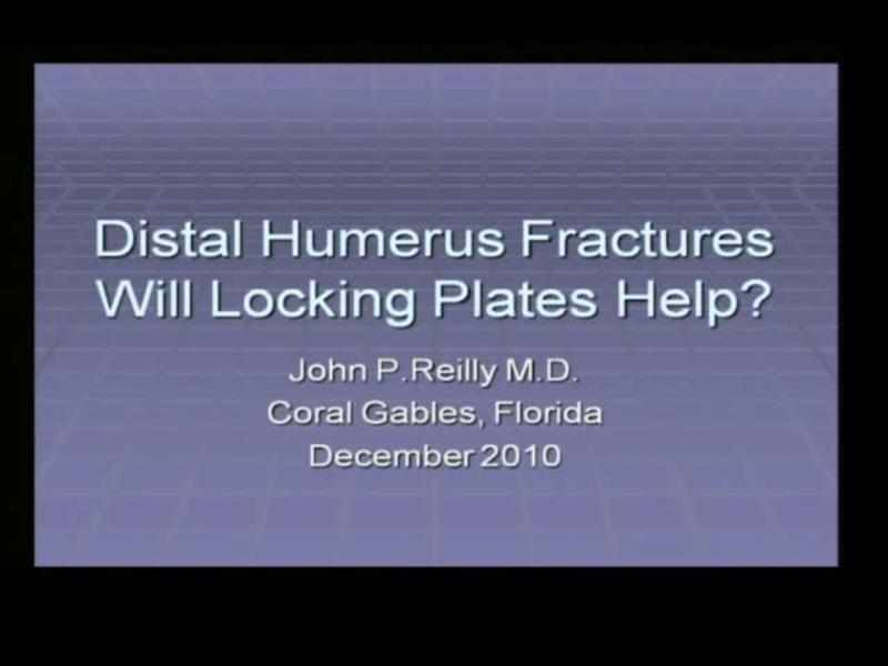 Distal Humerus Fractures - Will Locking Plates Help